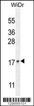UNQ5814 Antibody (C-term)