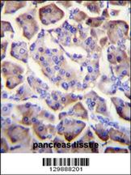 UNQ5814 Antibody (C-term)