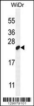 C19orf84 Antibody (C-term)