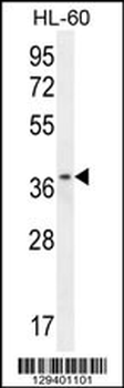 ZNF322B Antibody (C-term)