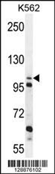 ZGRF1 Antibody (N-term)
