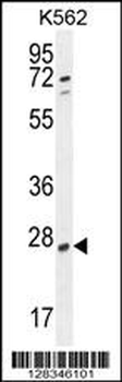 RPEL1 Antibody (C-term)