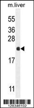 RPEL1 Antibody (C-term)