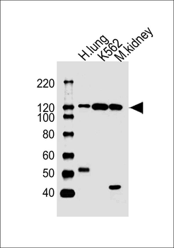 ROR1 Antibody