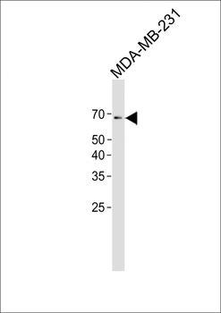 Estrogen Receptor alpha antibody