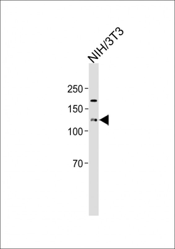 ROR1 antibody (C-term)