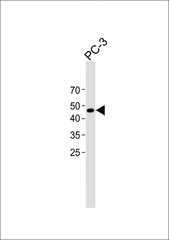 TROP2 antibody