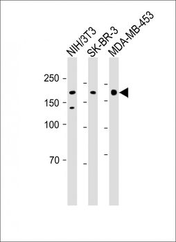 HER2 Antibody
