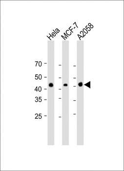 anti-MEK1 Antibody