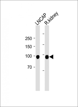 CD10 antibody