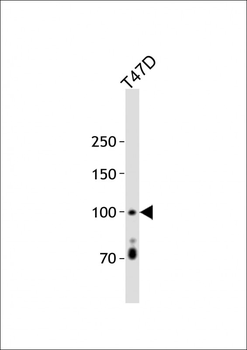 Androgen receptor Antibody