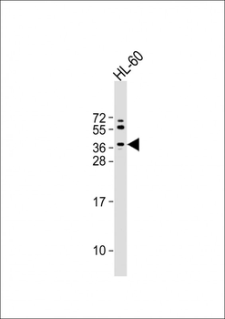 (Mouse) Trex2 Antibody (C-term)