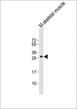 (Mouse) Trex2 Antibody (C-term)