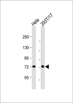 CAPN2 Antibody (Center)