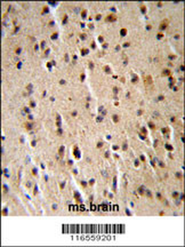 DPPA2 Antibody (N-term)