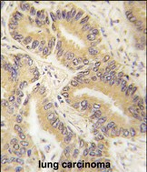 RAF1 Antibody (S339)