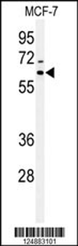IRGQ Antibody (N-term)
