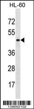 ARMCX4 Antibody (Center)
