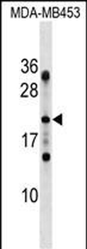 FAM173A Antibody (N-term)