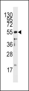 CD4 Antibody (C-term)