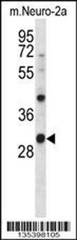 Mouse Csnk1a1 Antibody (C-term)
