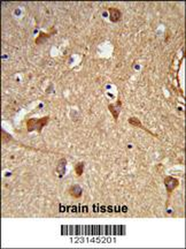 ALDH2 Antibody