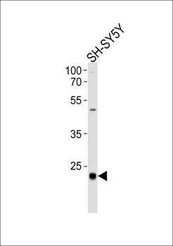 CEBPD Antibody (C-term)