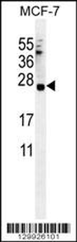 C20orf201 Antibody (C-term)