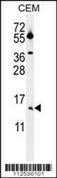 MGP Antibody (Center)