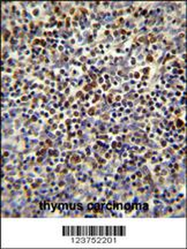 DNA2 Antibody (Center)