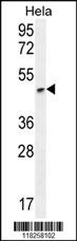 ANGPTL1 Antibody (N-term)