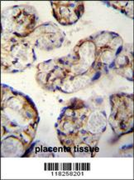 ANGPTL1 Antibody (N-term)