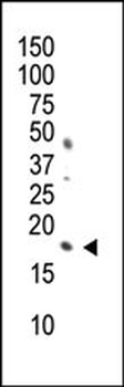 Phospho-Histone H3(S10) Antibody