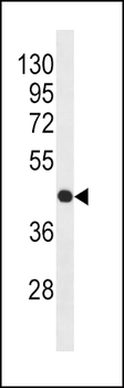 Beta-actin Antibody (Ascites)