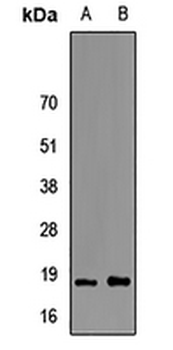 FABP6 Antibody
