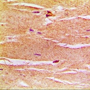 Frataxin Antibody