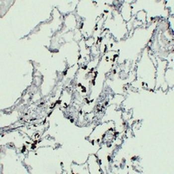 ACP5 Antibody