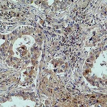 MICU1 Antibody