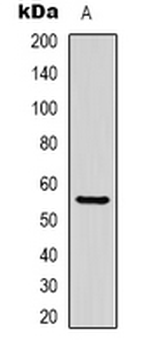 Beta-tubulin Antibody-HRP labled
