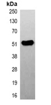 Beta2A-tubulin Antibody