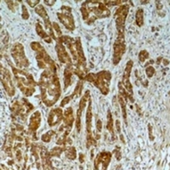 Alpha-tubulin (AcK40) Antibody