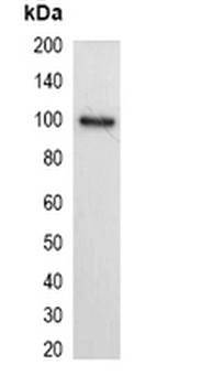 His-tag Antibody-HRP labled