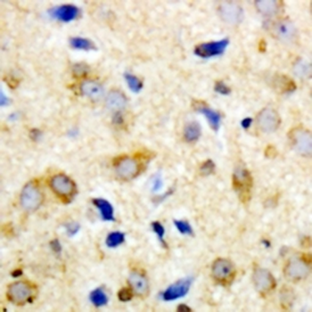 NPY5R Antibody