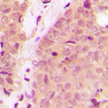 IKK alpha/beta Antibody