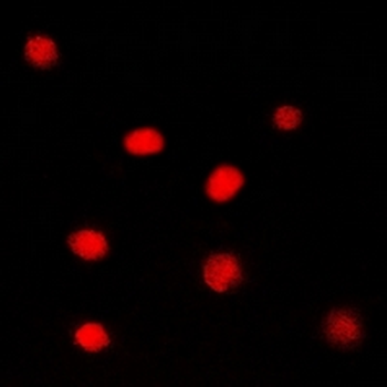 Glucocorticoid Receptor Antibody