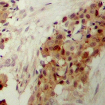p38 (pY182) Antibody