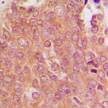 MID1 Antibody