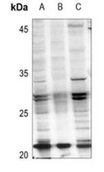 RAB21 (AcK109) Antibody