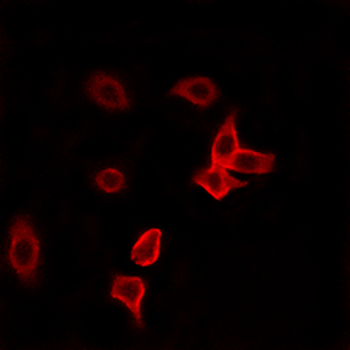 KANK2 Antibody