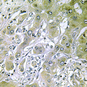 ACOT12 Antibody